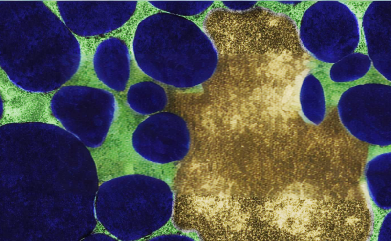 Allegria therapeutics secures usd 5.1 million seed extension financing